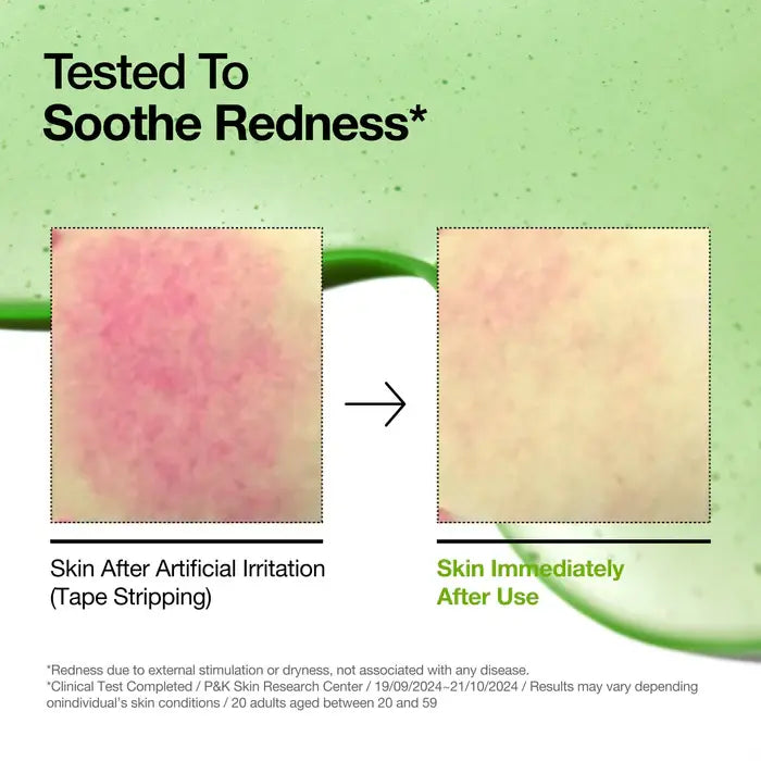 Suero Calmante Azelaic Acid 10 Hyaluron Anua 30ml - Iconika Beauty Shop