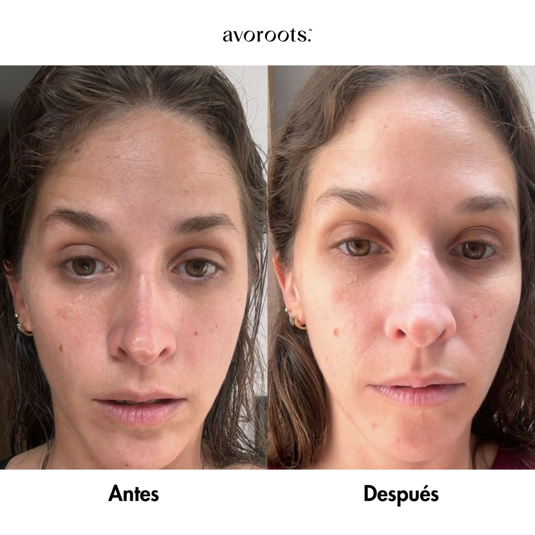 Suero contorno de ojos Avoroots 15 ml.