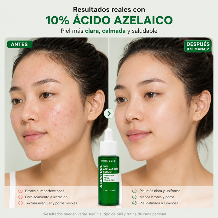 Suero Nineless A-Control Acido Azelaico 30 ml