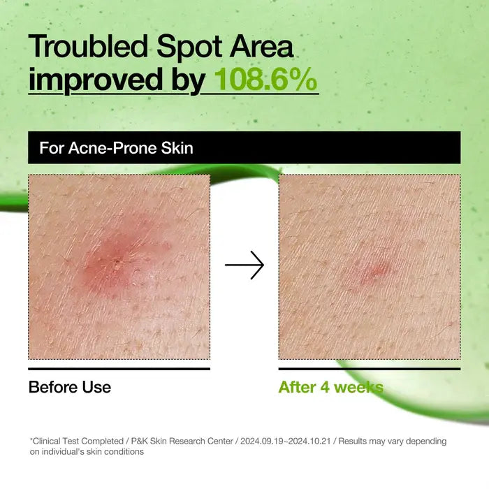 Suero Calmante Azelaic Acid 10 Hyaluron Anua 30ml - Iconika Beauty Shop