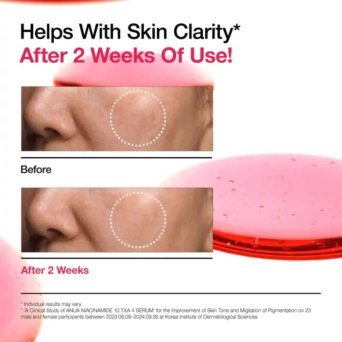 Suero Niacinamide 10 TXA 4 Anua 30ml - Iconika Beauty Shop